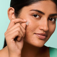Mighty Patch™ for Early-Stage Blemishes - Spot Support