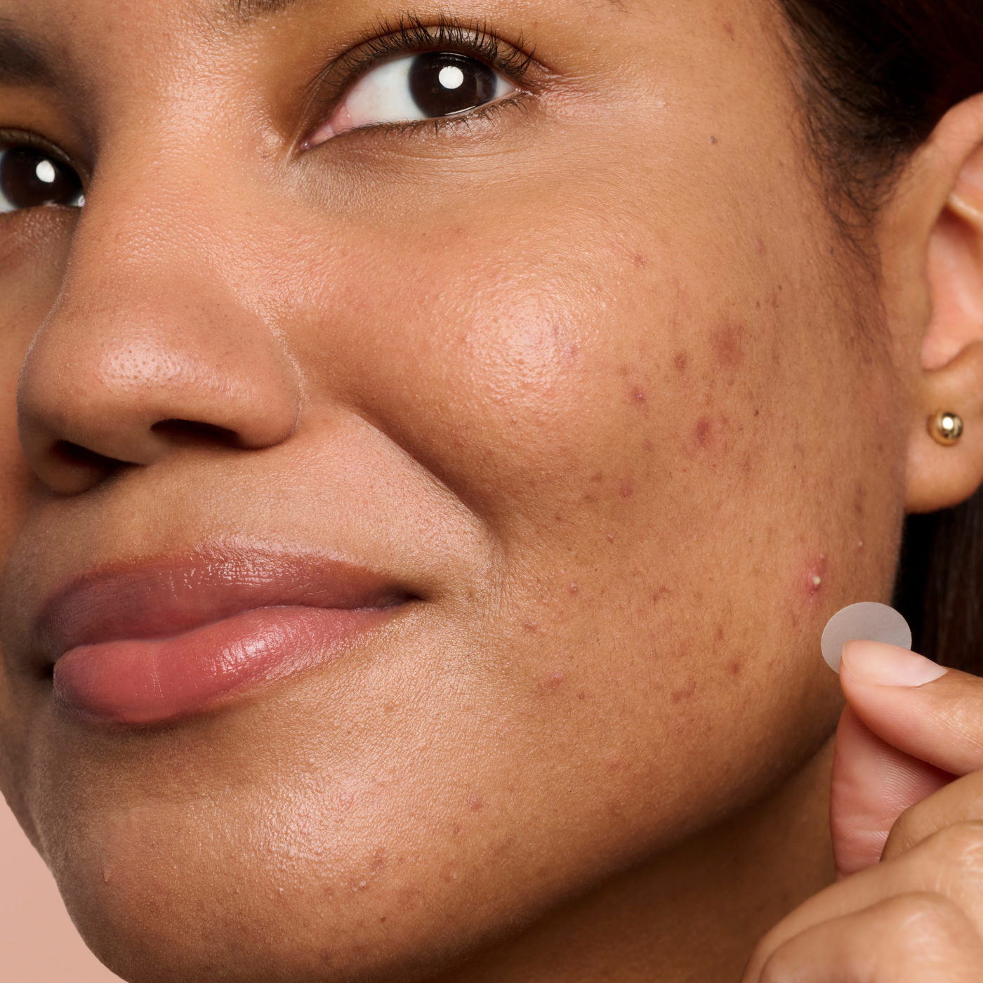 Blemish Control Duo - Spot Pair
