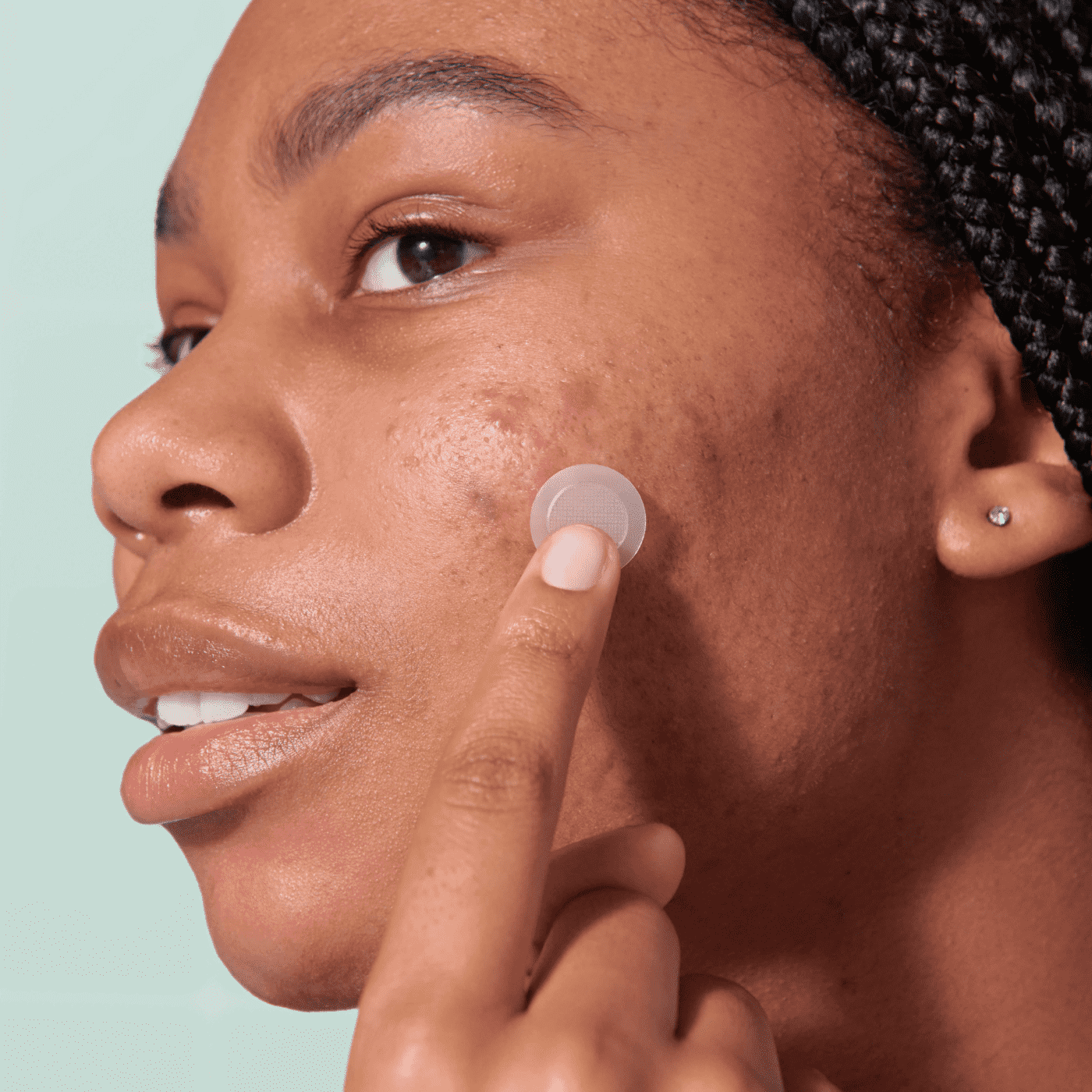 Mighty Patch™ for Early-Stage Blemishes - Blemish Care
