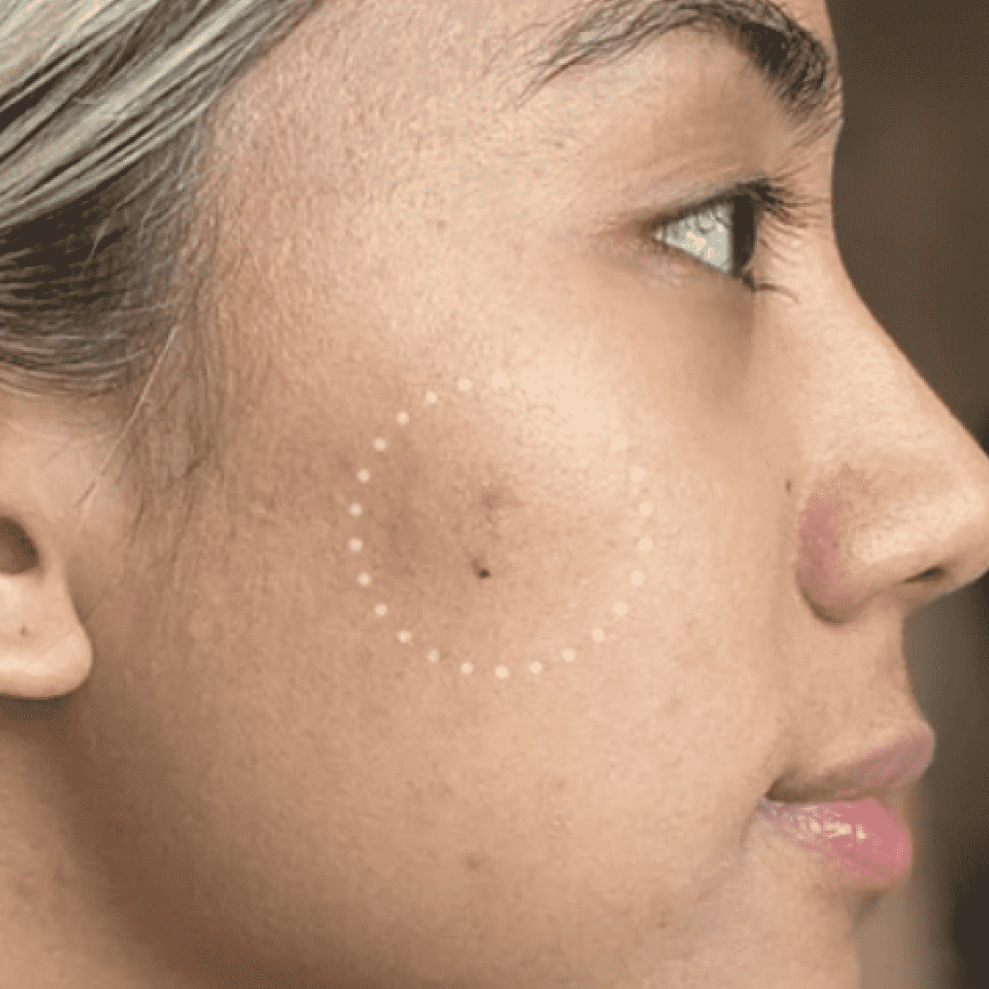 Mighty Patch™ for Dark Spots - Bright Care