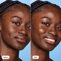 Glow Balm - Glow Support