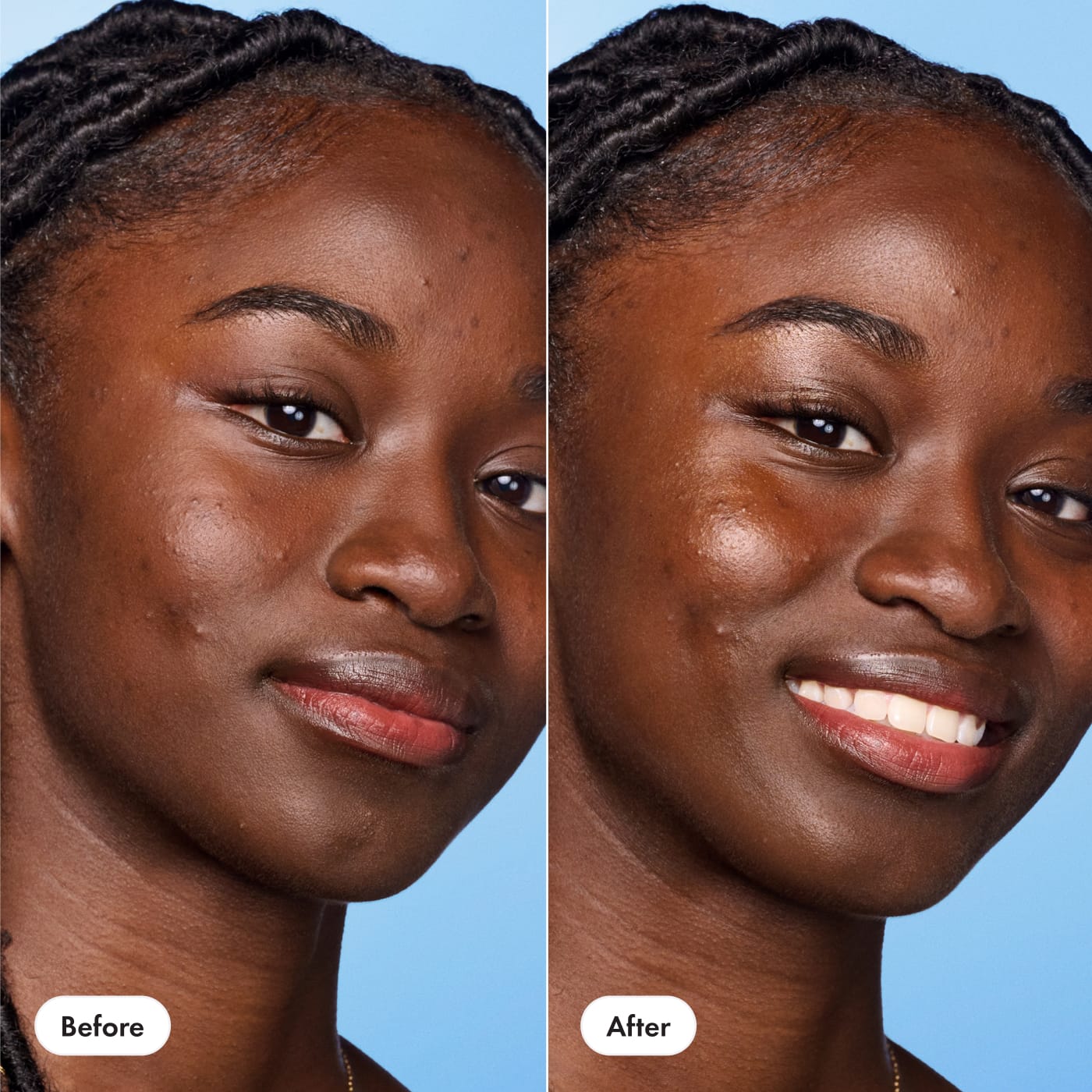 Glow Balm - Glow Support